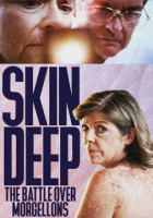 Skin_deep